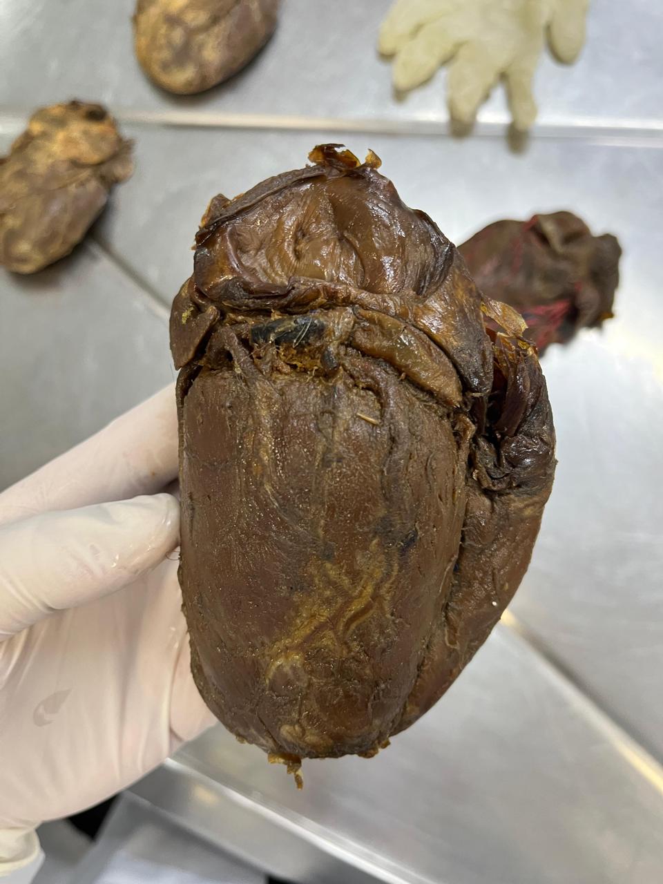 Anatomia do Coração